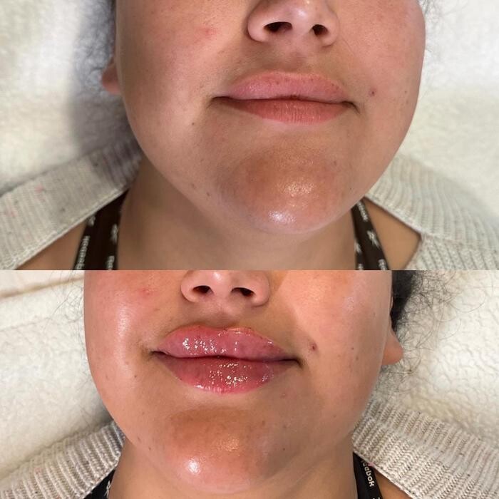 Images Subtle Aesthetics