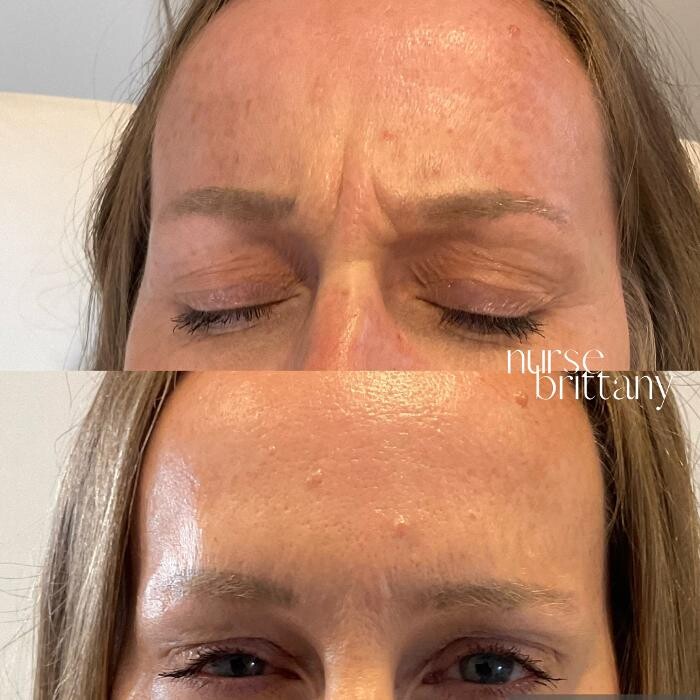 Images Subtle Aesthetics