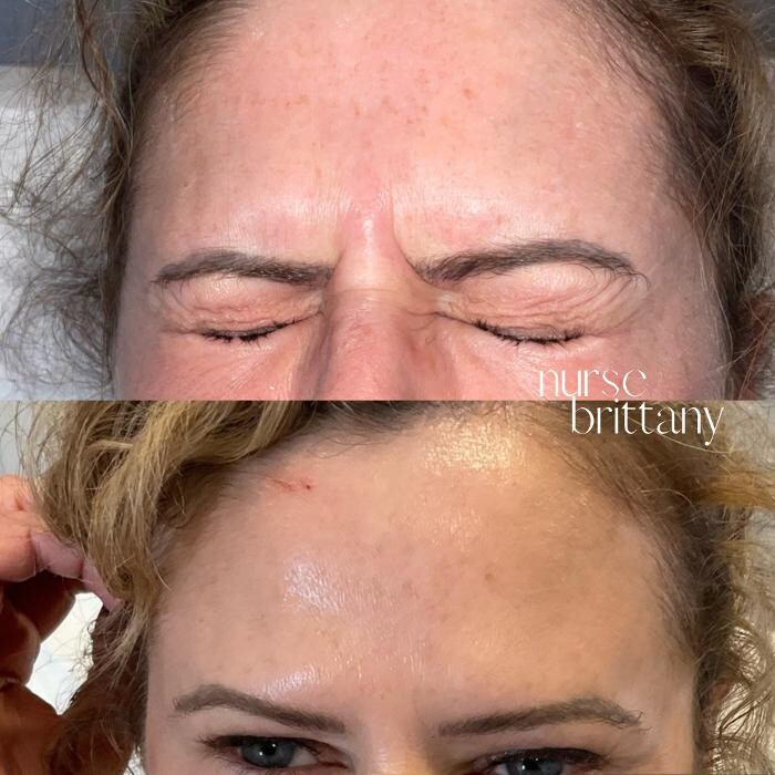 Images Subtle Aesthetics