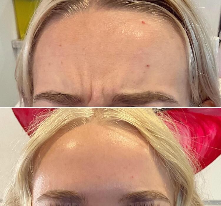 Images Subtle Aesthetics