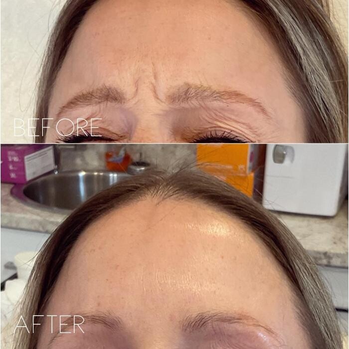 Images Subtle Aesthetics