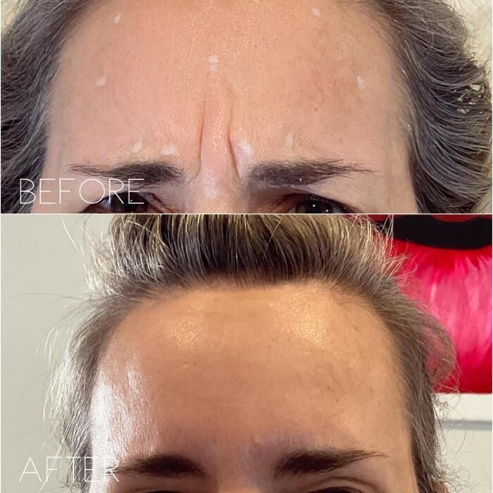 Images Subtle Aesthetics