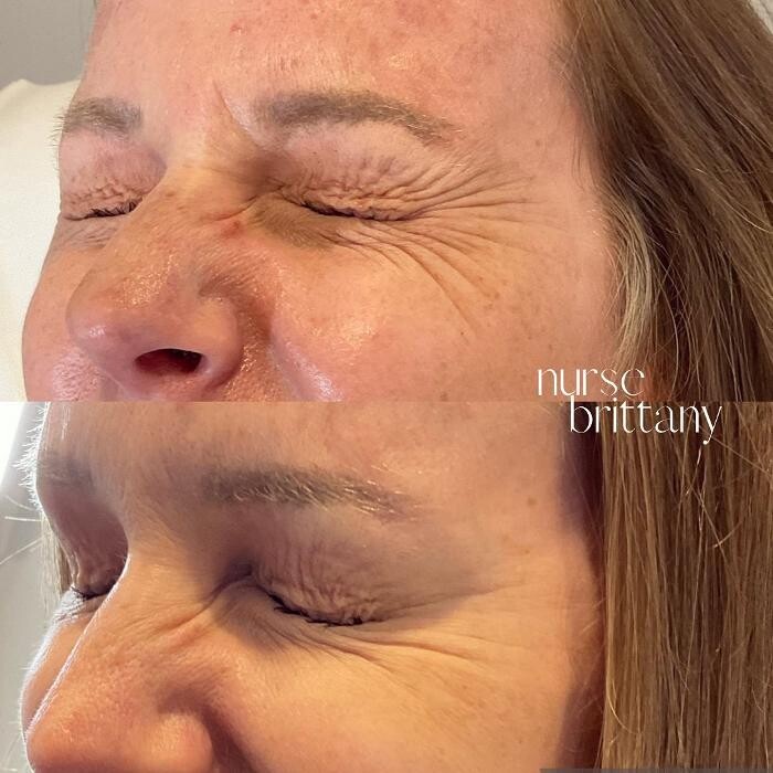 Images Subtle Aesthetics