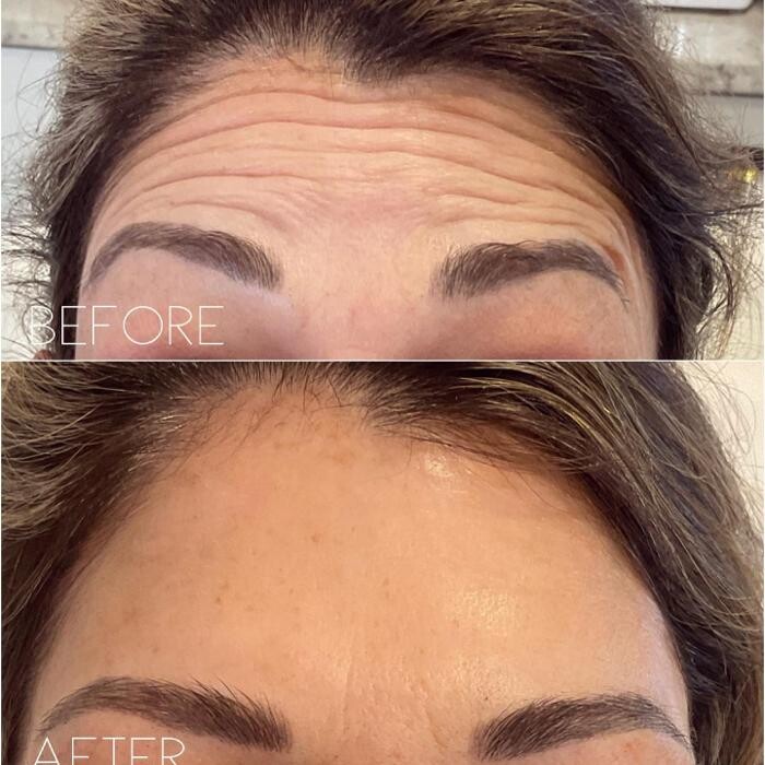 Images Subtle Aesthetics