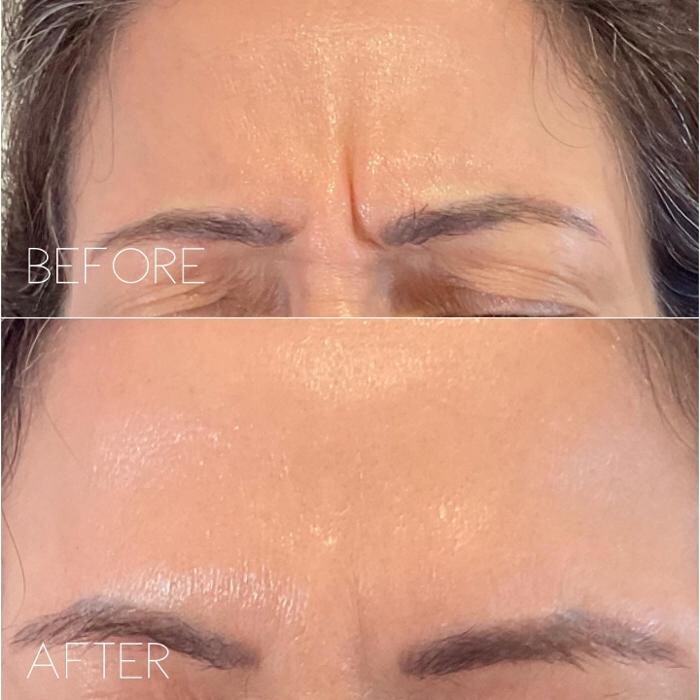 Images Subtle Aesthetics