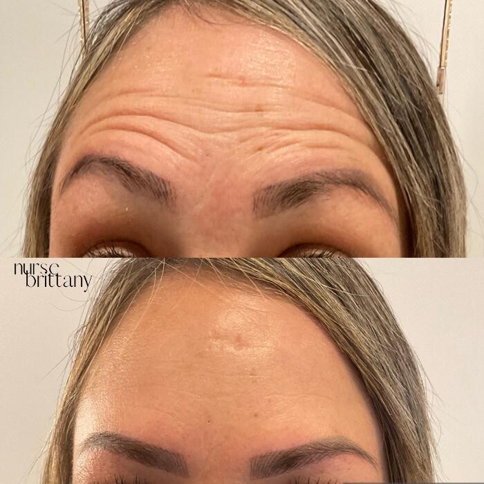 Images Subtle Aesthetics