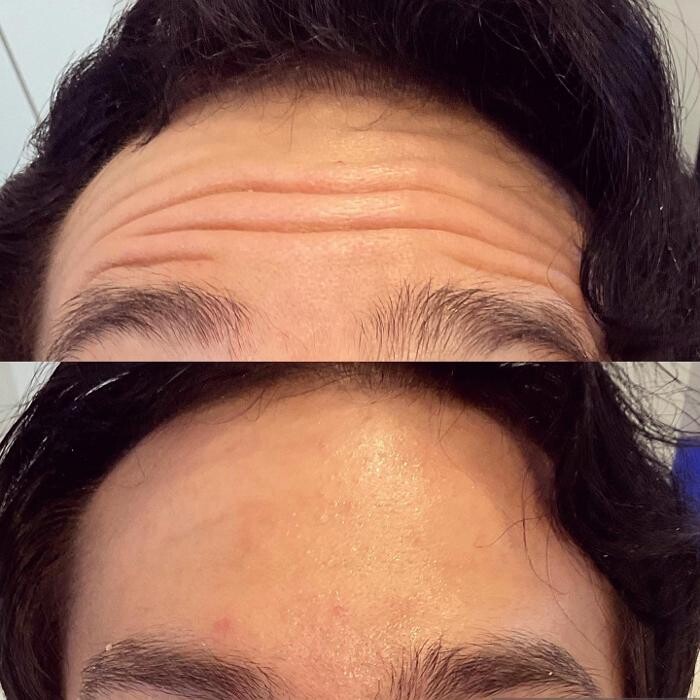 Images Subtle Aesthetics