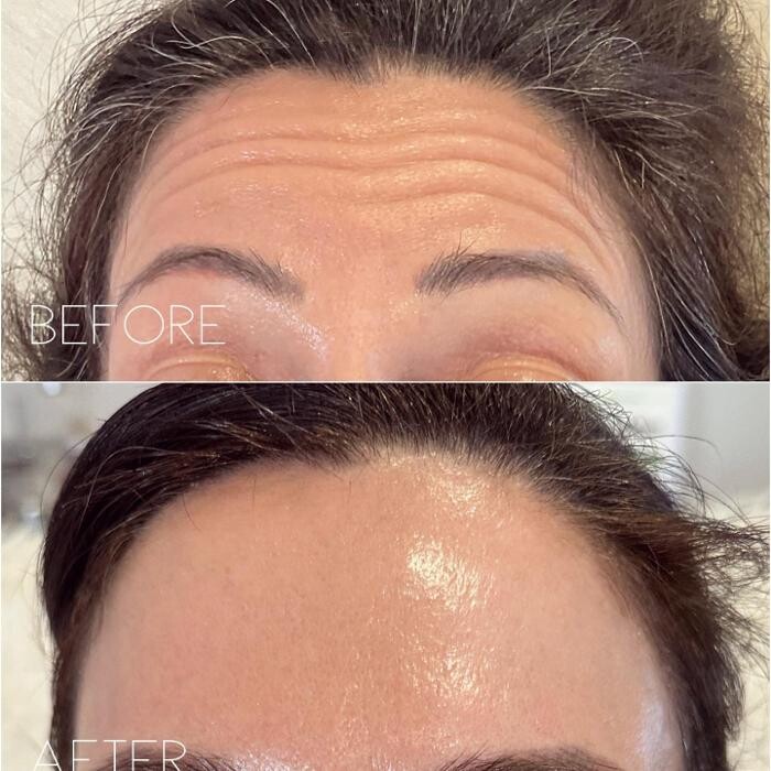 Images Subtle Aesthetics