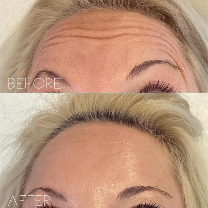 Images Subtle Aesthetics