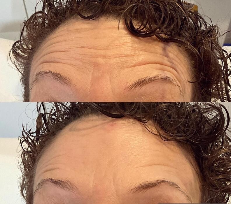 Images Subtle Aesthetics