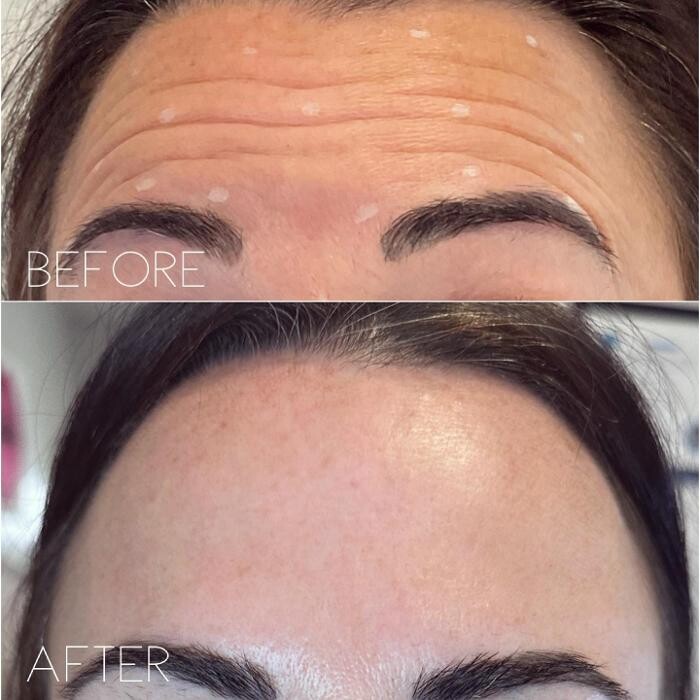 Images Subtle Aesthetics