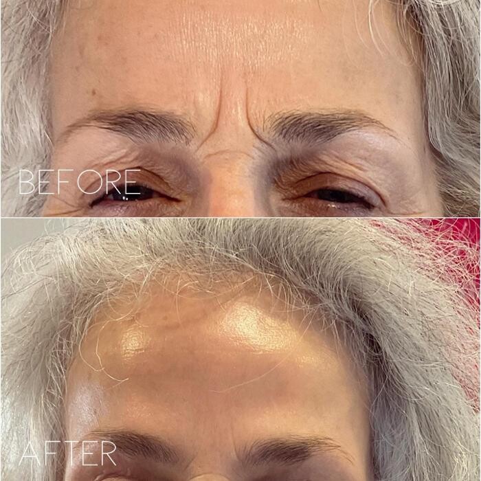 Images Subtle Aesthetics