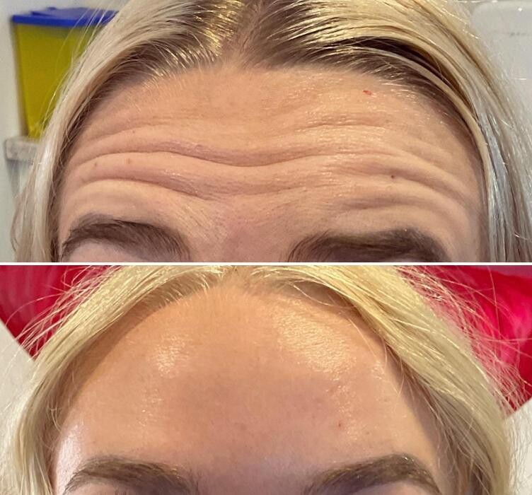 Images Subtle Aesthetics