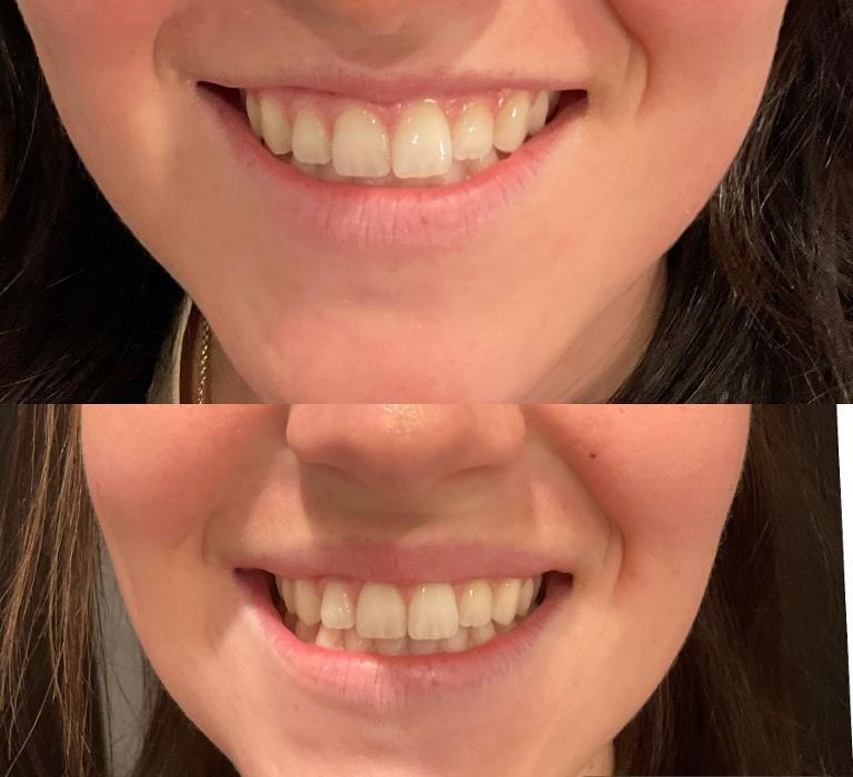 Images Subtle Aesthetics