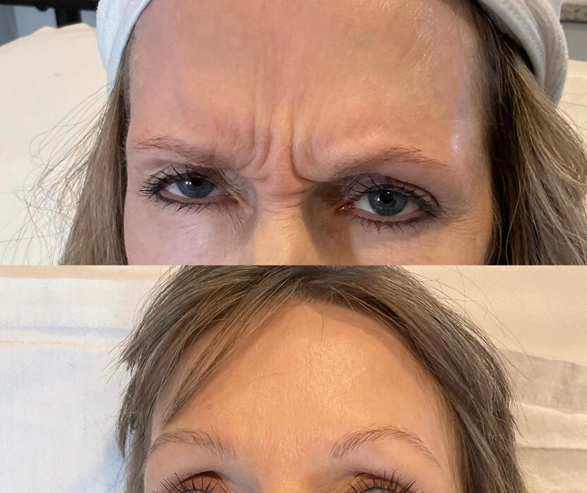 Images Subtle Aesthetics