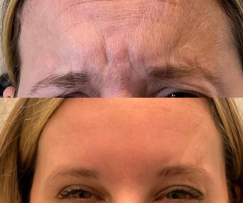 Images Subtle Aesthetics