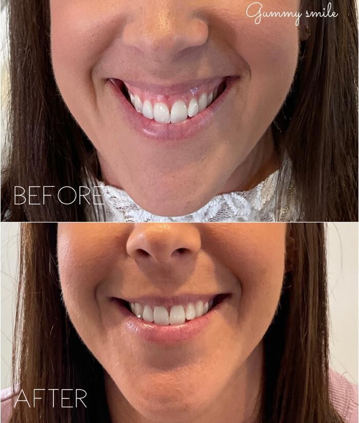 Images Subtle Aesthetics