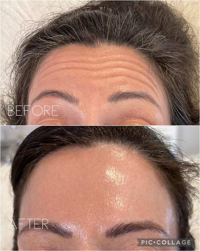 Images Subtle Aesthetics