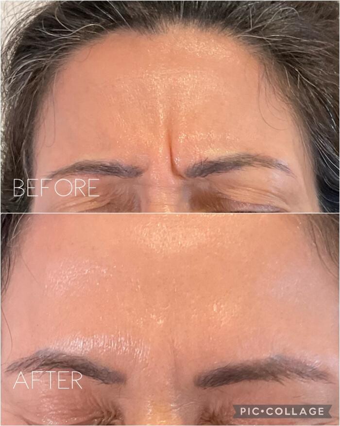 Images Subtle Aesthetics