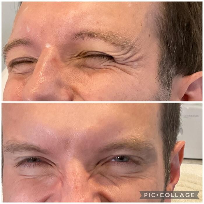 Images Subtle Aesthetics