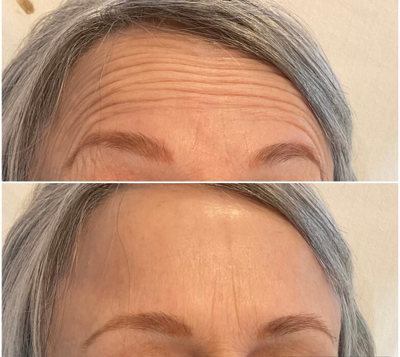 Images Subtle Aesthetics