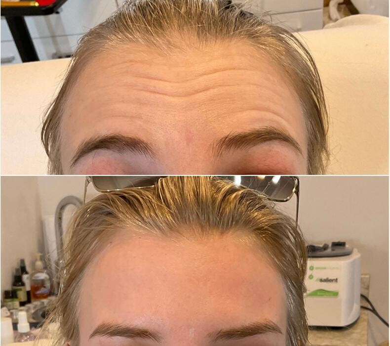 Images Subtle Aesthetics