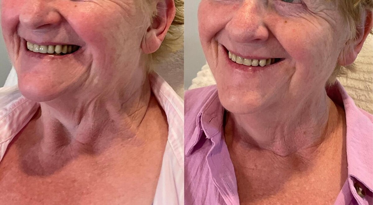 Images Subtle Aesthetics