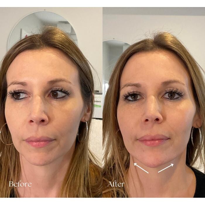 Images Subtle Aesthetics