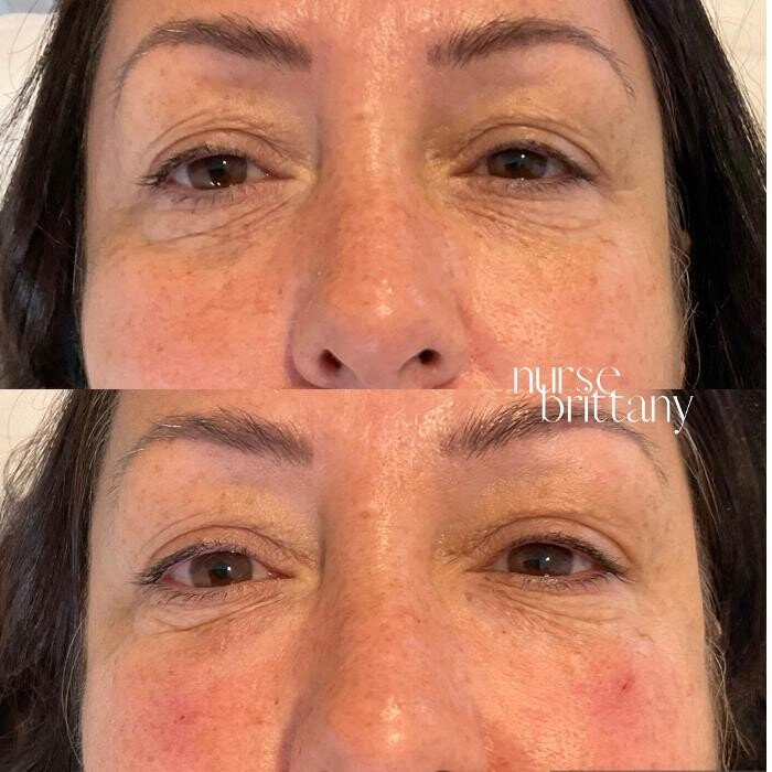 Images Subtle Aesthetics