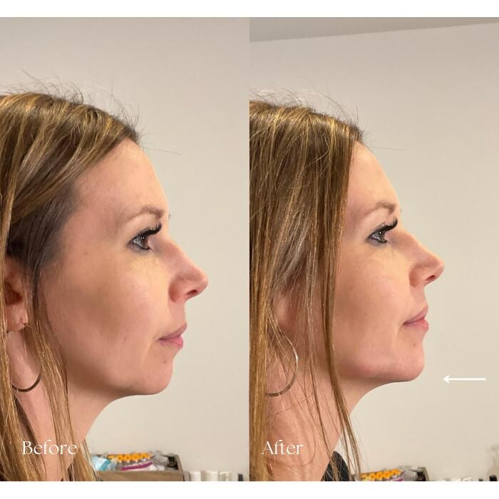 Images Subtle Aesthetics