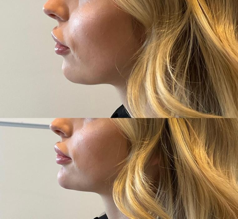 Images Subtle Aesthetics