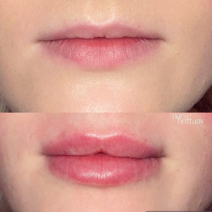 Images Subtle Aesthetics