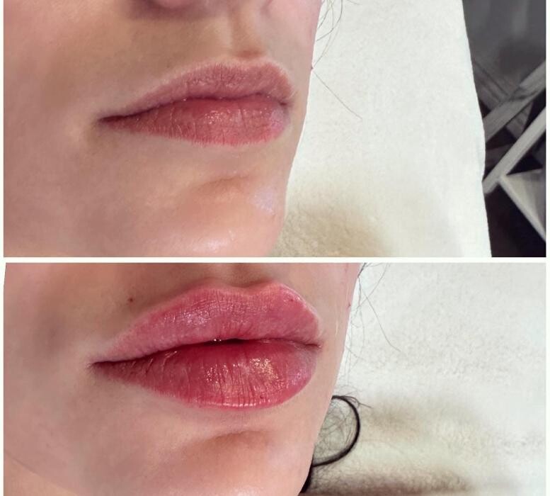 Images Subtle Aesthetics