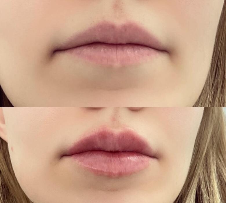 Images Subtle Aesthetics