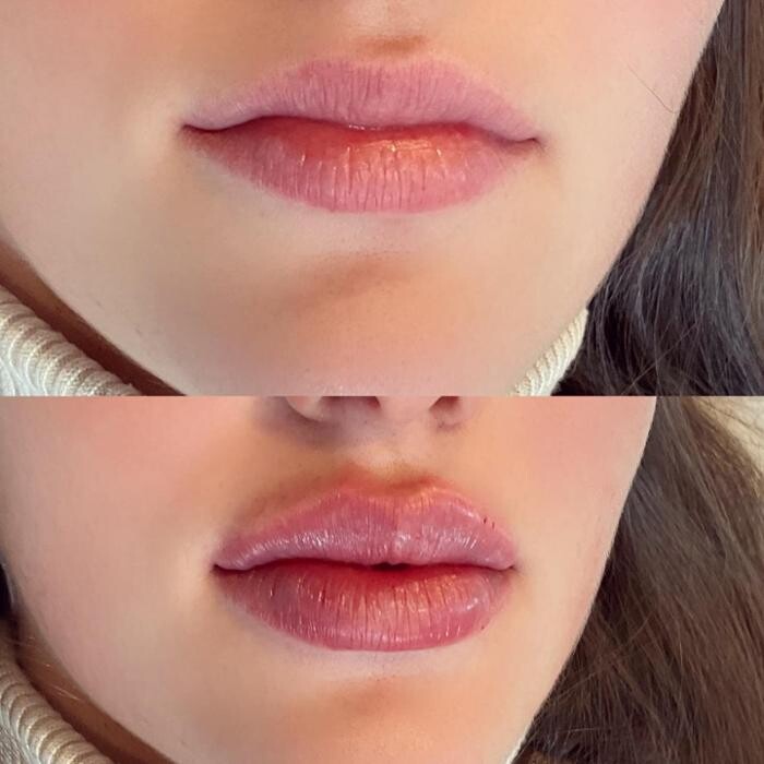 Images Subtle Aesthetics