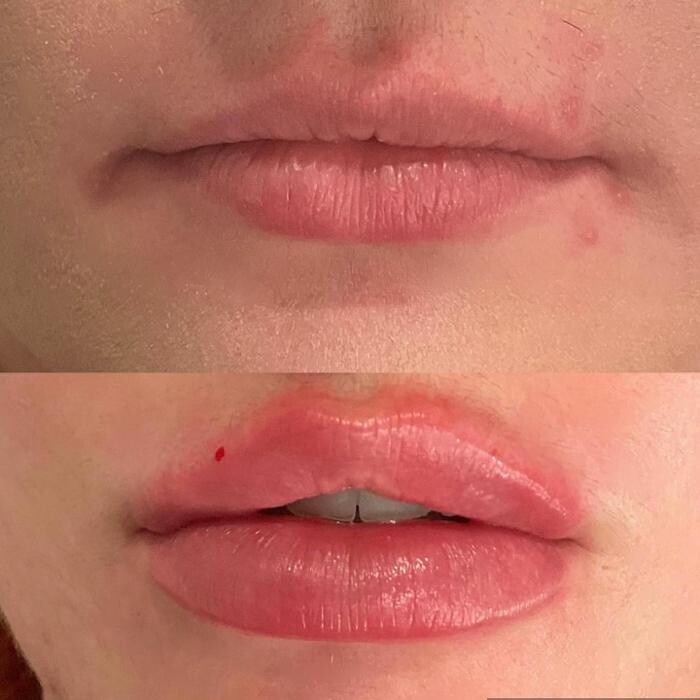 Images Subtle Aesthetics