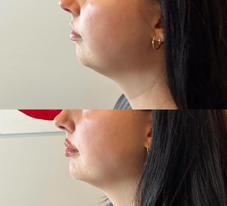 Images Subtle Aesthetics