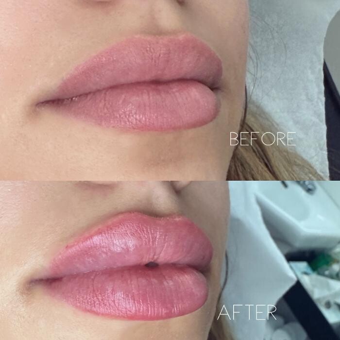 Images Subtle Aesthetics