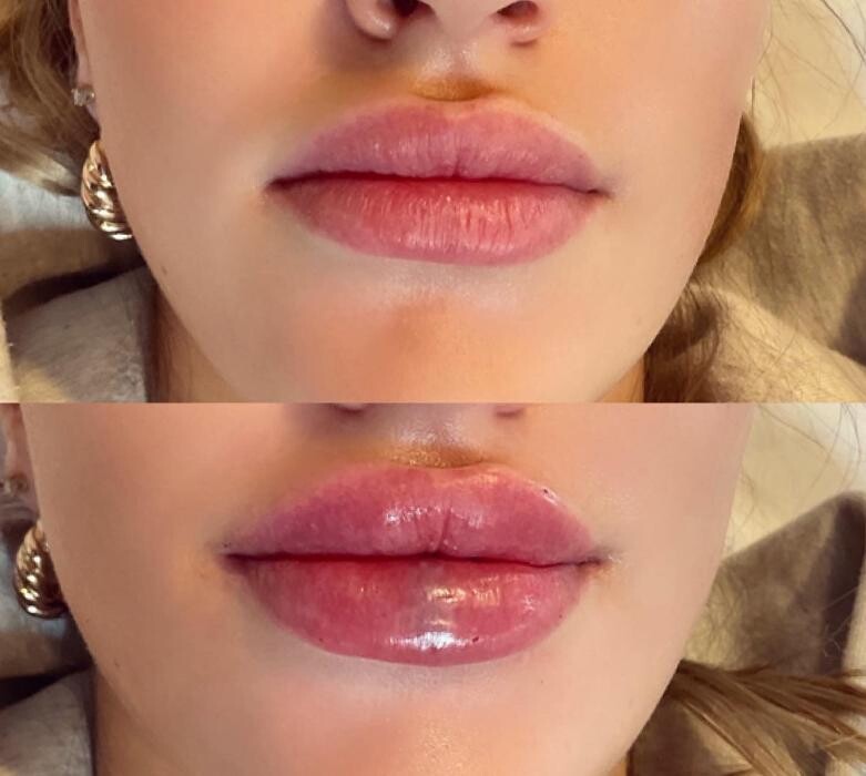 Images Subtle Aesthetics