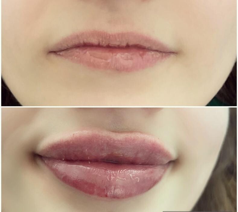 Images Subtle Aesthetics