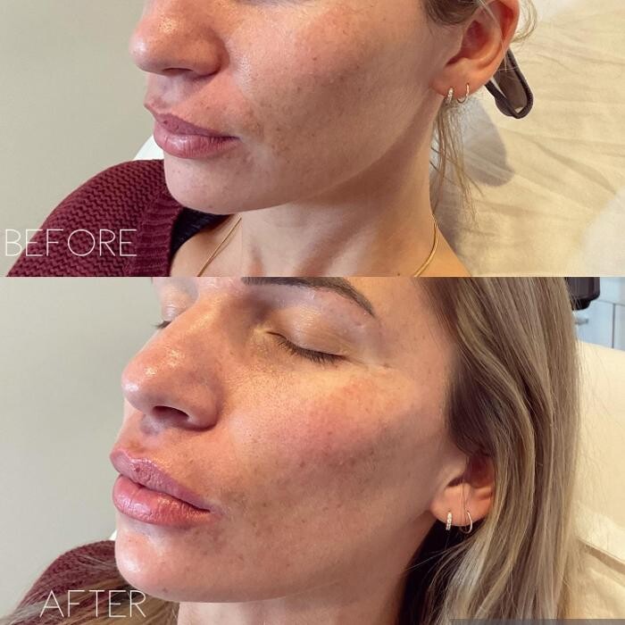 Images Subtle Aesthetics