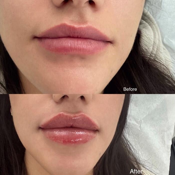 Images Subtle Aesthetics