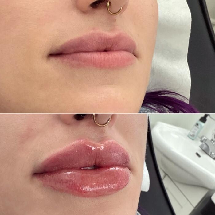 Images Subtle Aesthetics