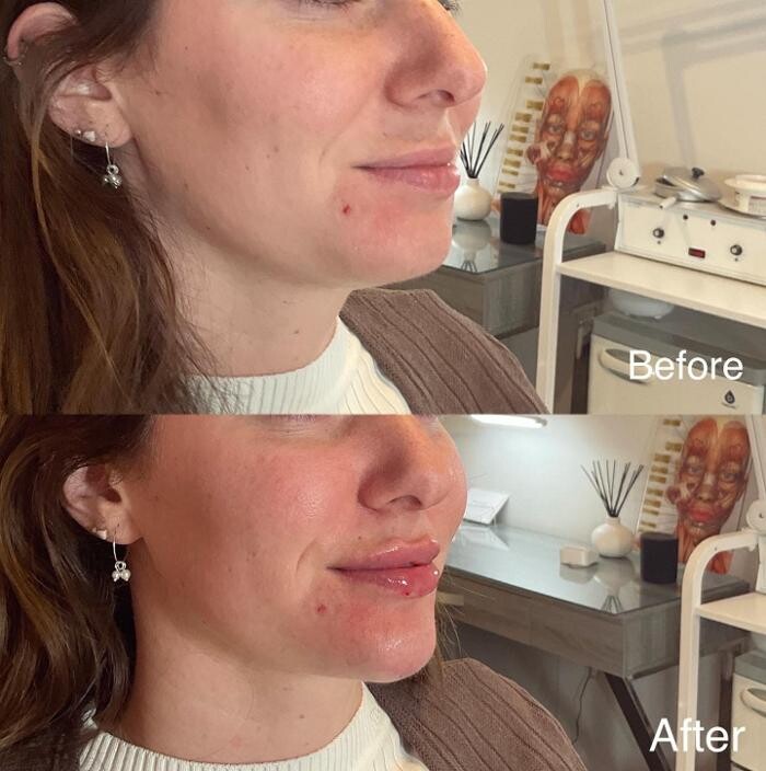 Images Subtle Aesthetics