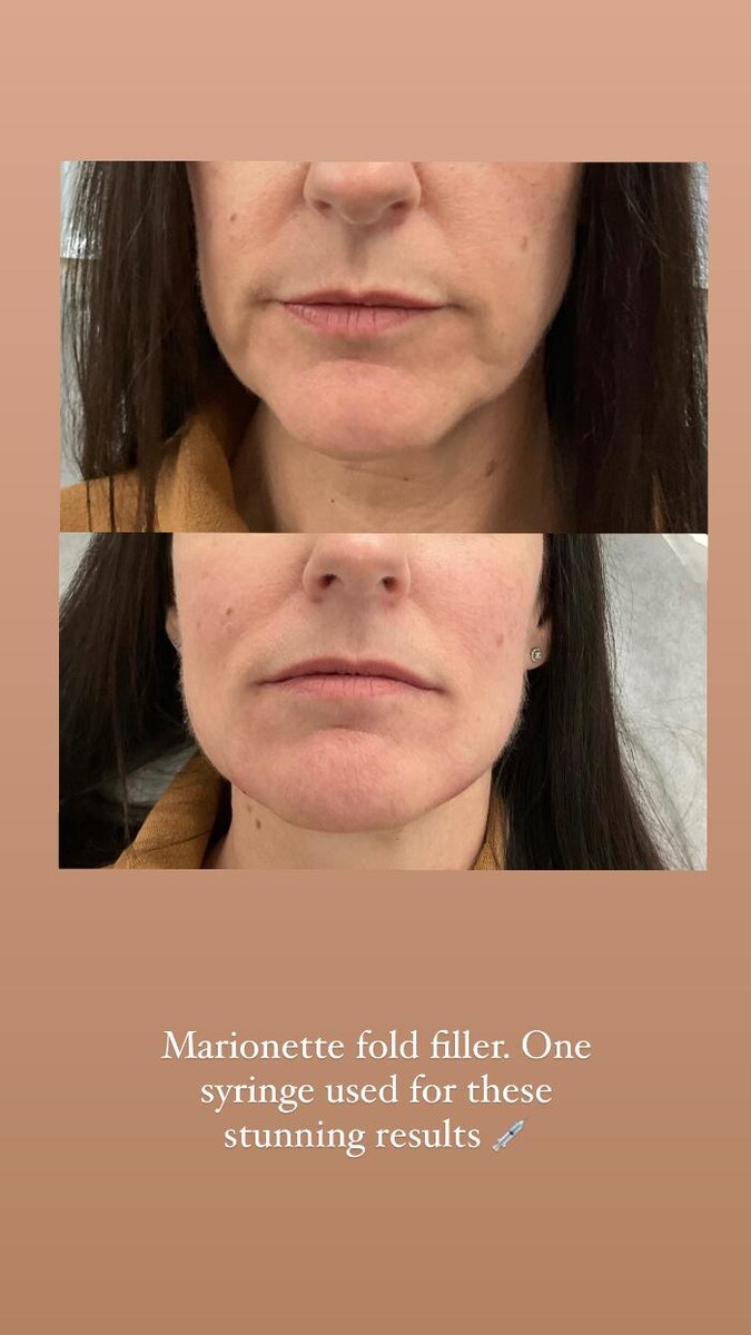 Images Subtle Aesthetics