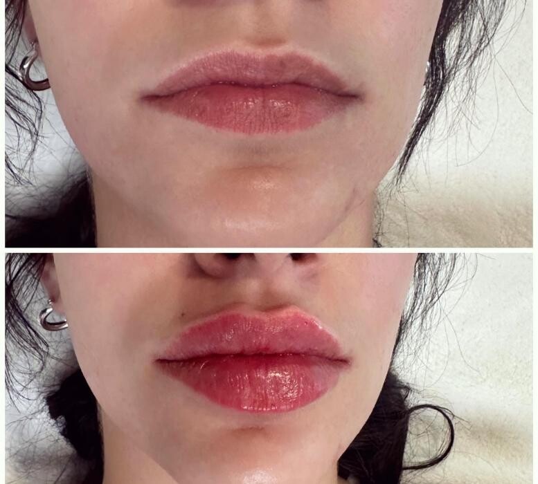 Images Subtle Aesthetics