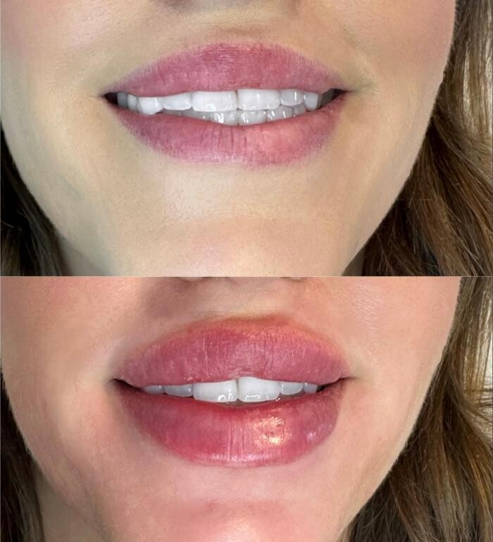 Images Subtle Aesthetics