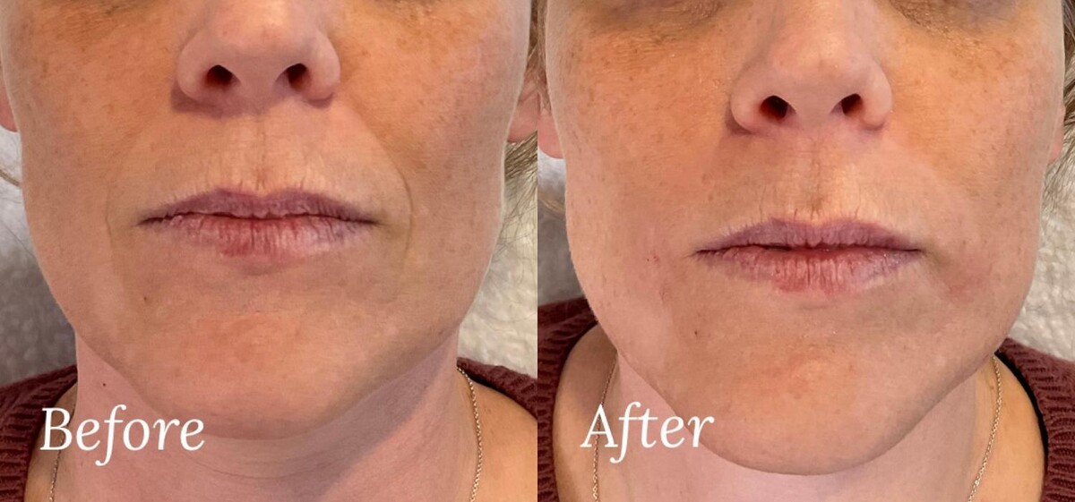 Images Subtle Aesthetics