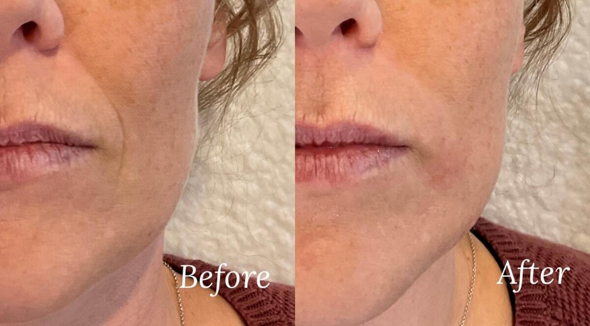 Images Subtle Aesthetics