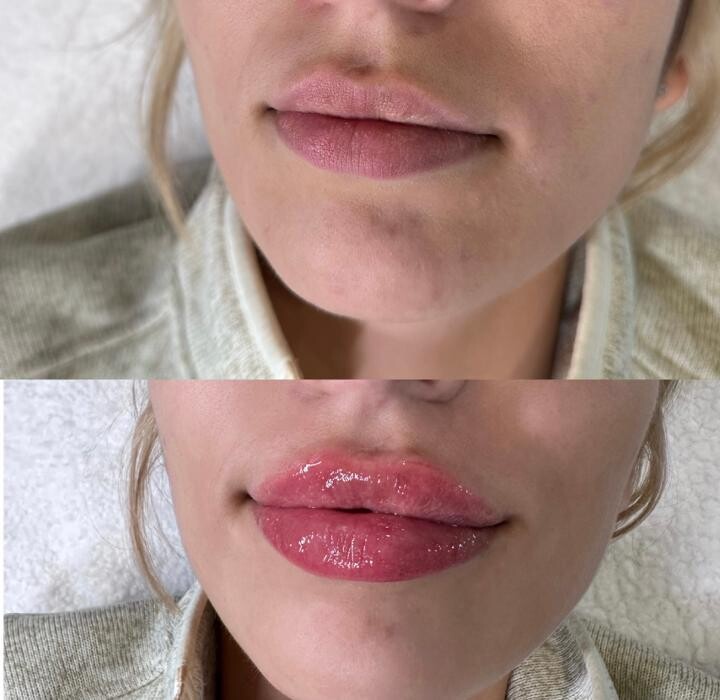 Images Subtle Aesthetics